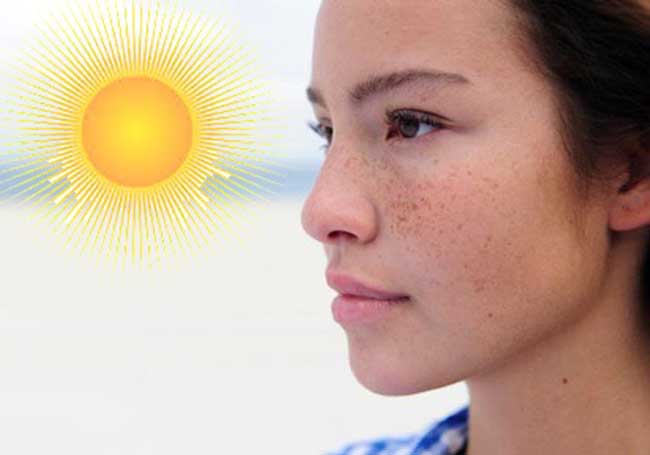 Ánh sáng mặt trời là yếu tố hàng đầu gây ra nám.
