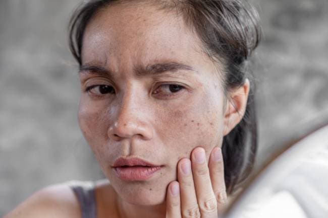 Kem trộn ảnh hưởng xấu đến làn da của mình