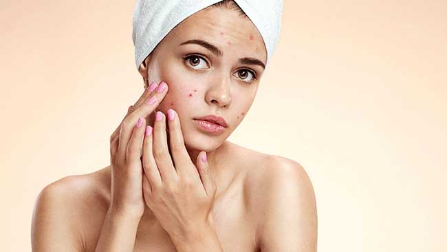 Quá trình chăm sóc da không đúng có thể dẫn đến một số bệnh lý về da.