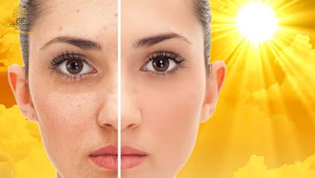 Cách hiệu quả nhất để sử dụng Vitamin E điều trị chứng tăng sắc tố là kết hợp với vitamin C.