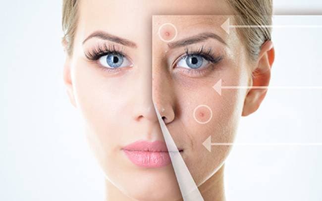 Sản phẩm trị mụn an toàn