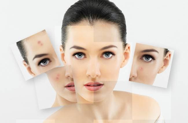 Sản phẩm trị mụn chất lượng cao