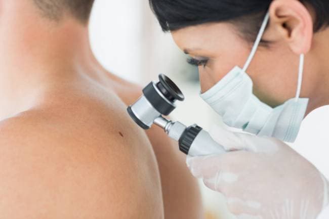 Sử dụng các sản phẩm tắm trắng không an toàn gây ung thư da