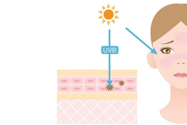 Tia UVB bị tầng ozon hấp thụ một phần nhưng một số tia vẫn xuyên qua được.